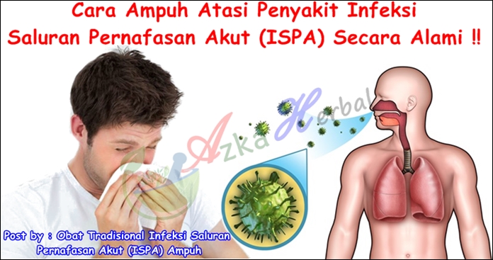 Obat Tradisional Infeksi Saluran Pernafasan Akut (ISPA) Ampuh